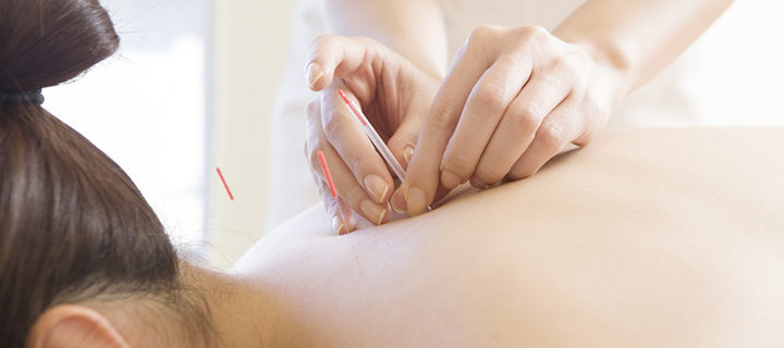 子宮や卵巣の血流をアップ「子宝鍼灸＋ラジオ波」